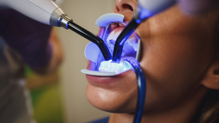 materiais restauradores